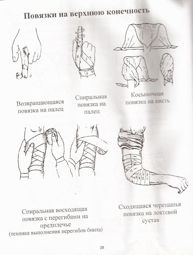 Повязка при капиллярном кровотечении